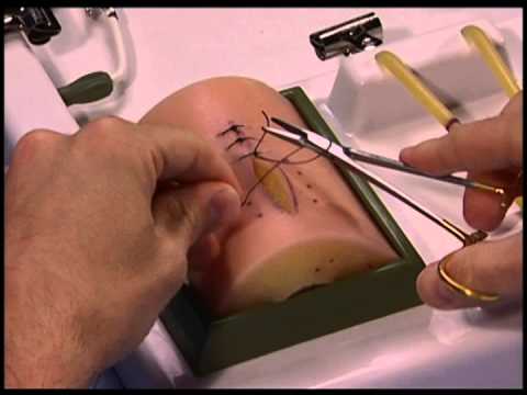 Common Errors in Performing an Instrument Tie: needle driver from outside example 1