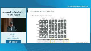 제 27차 서울아산병원 호흡기내과 연수강좌:폐암 진단 및 치료의 최신지견 : AI capability of evaluation for lung nodule 미리보기