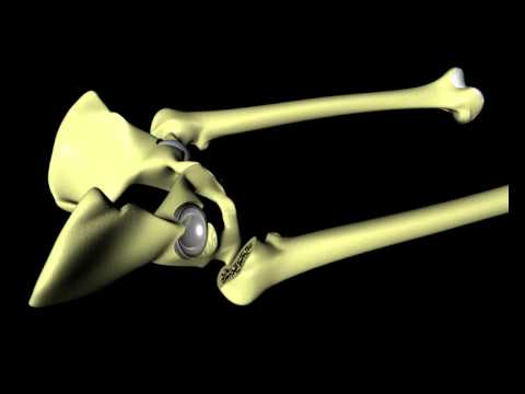 Infiammazione del gomito I sintomi del distretto della malattia degenerativa del disco del toracica