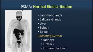 Should I Order a PET Scan? (2025)