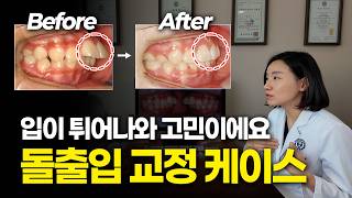 유튜브썸네일