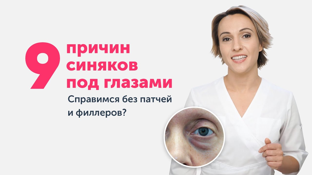 9 причин СИНЯКОВ ПОД ГЛАЗАМИ: справимся без патчей и филлеров