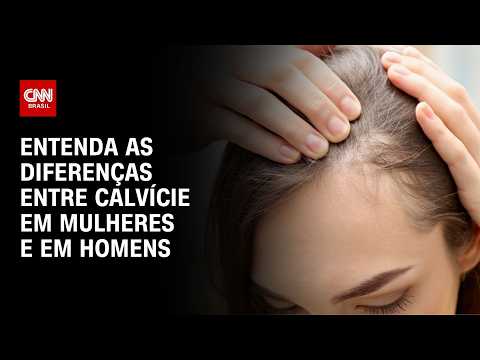 Calvície feminina é diferente da masculina e bastante comum, diz especialista | CNN SINAIS VITAIS