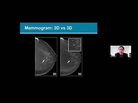 Blum Center Program: Screening for Breast Cancer