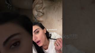 Download lagu Fact or Cap: Mole Removal Cream #shorts | SkinByDrAzi mp3 Download lagu Fact or Cap: Mole Removal Cream #shorts | SkinByDrAzi mp3