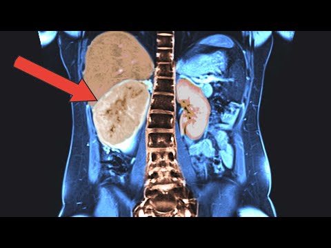 What Was Growing In Her Body Was Said To Not Exist...