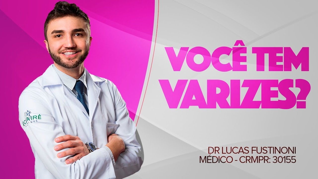 VOCÊ TEM VARIZES? Fica muito tempo em pé? - Dr Lucas Fustinoni - Médico - CRMPR  30155