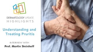 Understanding and Treating Pruritus - Dermatology Update 2016