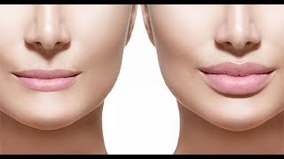 ARE LIP FILLERS SAFE? DISCUSSION WITH DERMATOLOGIST DR. ELIOT BATTLE OF CULTURA MED SPA