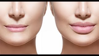 ARE LIP FILLERS SAFE? DISCUSSION WITH DERMATOLOGIST DR. ELIOT BATTLE OF CULTURA MED SPA