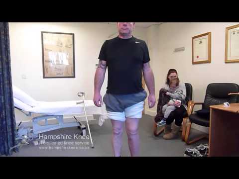 HTO - early weight bearing at 3 weeks