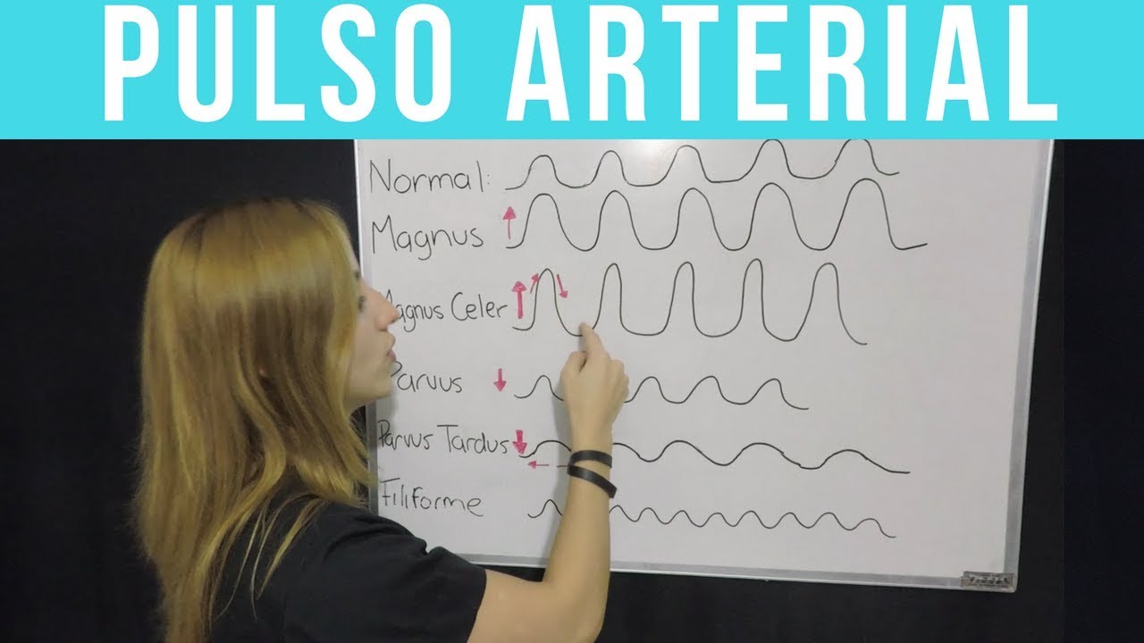 PULSO ARTERIAL ¡Todo lo que tienes que saber!  | Mentes Médicas