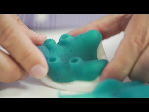 3D Druck im Dentallabor: generative Herstellung individueller Abformlöffeln mit Freeprint® tray