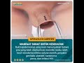 Manfaat Sunat Untuk Kesehatan