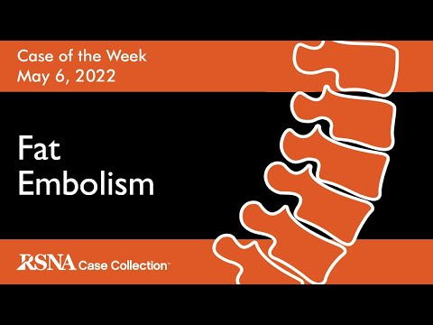 Case of the Week: Fat Embolism