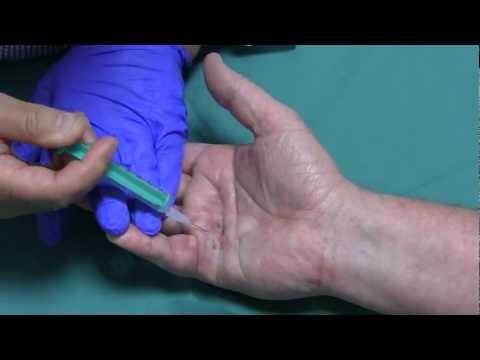 Sowie als zervikale thorakale Osteochondrose zu behandeln Mit Rückenschmerzen können in einem Bad sein