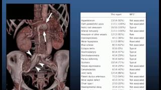 Prof Richmond Jeremy: Familial aortic diseases