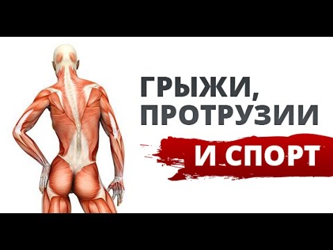 Как лечить сколиоз сильной степени Корректор осанки тамбов