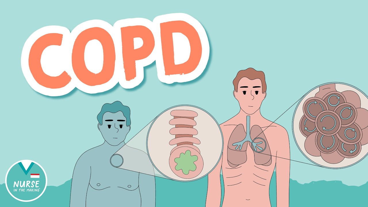 COPD - Chronic Obstructive Pulmonary Disease (Emphysema vs. Chronic Bronchitis)