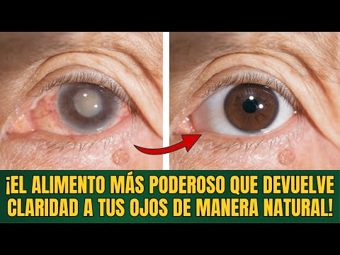 BLURRY VISION? THIS CHEAP AND POWERFUL FOOD CLEARS YOUR SIGHT IN WEEKS!