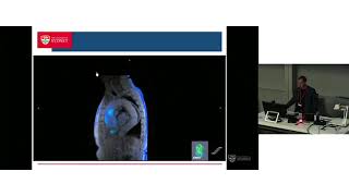 4D-Flow MRI of the Thoracic Aorta – Prof Stuart Grieve