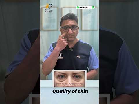 Blepharoplasty Patient Testimonial