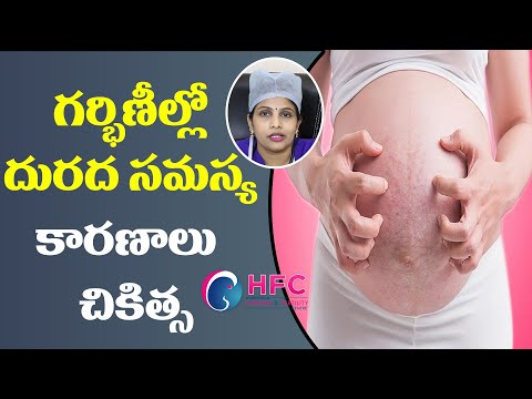 గర్భిణీల్లో దురద సమస్యకు ఇలా చెక్ పెట్టొచ్చు.! - remedies for itching during pregnancy