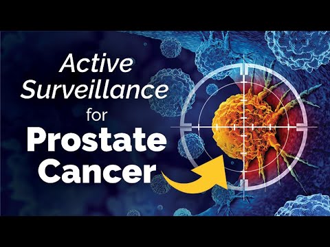 Active Surveillance for Prostate Cancer