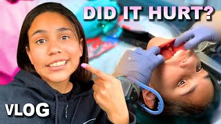 I GOT TEETH EXTRACTED AND BRACES (DID IT HURT?)