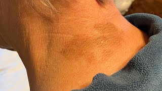 Por qué salen manchas oscuras en la piel