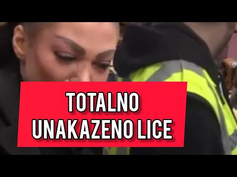 HOROR u Eliti! Maja Marinkovic UNAKAZILA LICE Boginji! Jezive i potresne scene