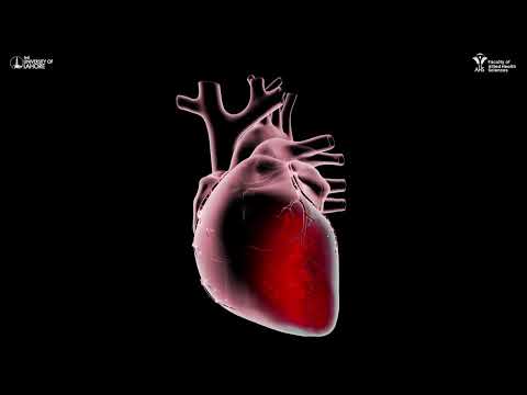 Anterior Myocardial Ischemia - 3D Animation