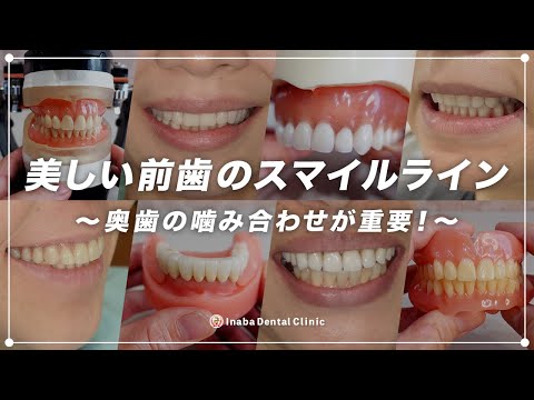 美しい前歯のスマイルライン 〜奥歯の噛み合わせが重要！〜