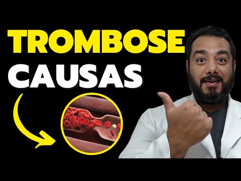 What are the main causes of thrombosis? Learn about the risk factors | Prof. Dr. Victor Proença