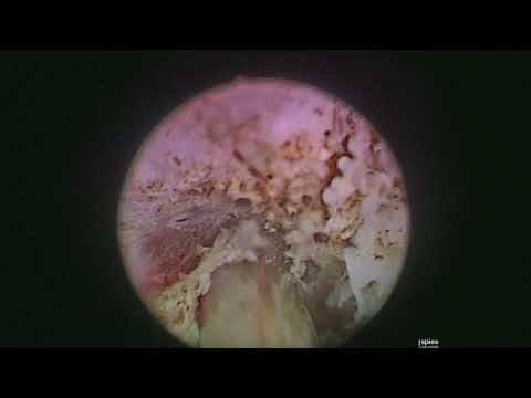 Guarda prostata moglie massaggio marito Trattamento della descrizione prostatica adenoma