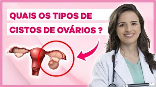 Tipos de Cisto no Ovário e Quando devemos fazer cirurgia