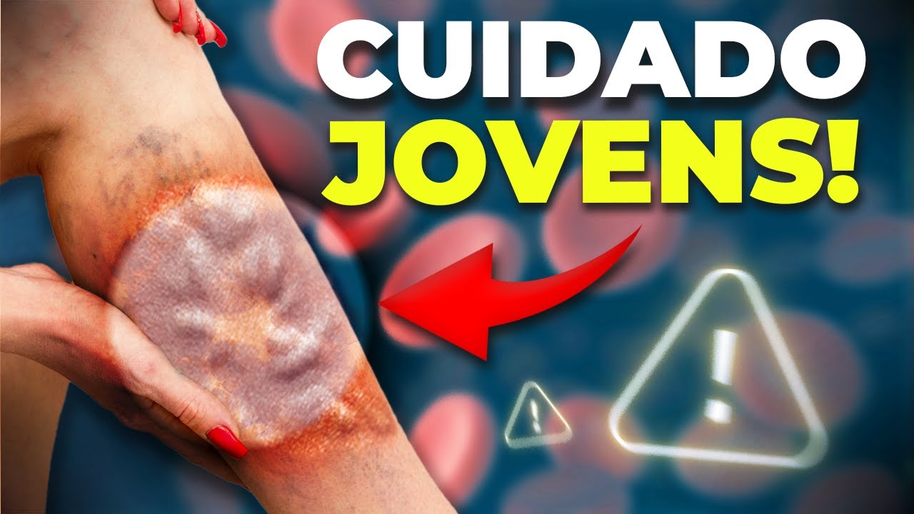 This Common Cardiovascular Problem is Threatening MILLIONS OF YOUNG PEOPLE