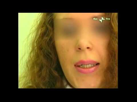 Soldati con giunti mobili Lombalgia con