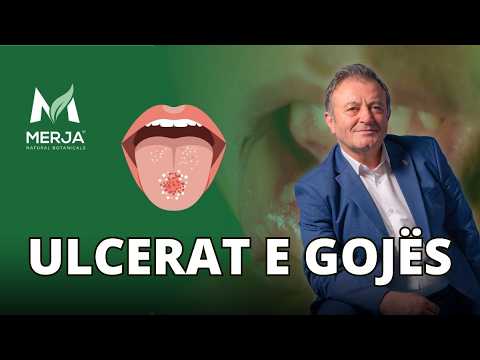 Ylli Merja - Plagë të dhimbshme në gojë? Çfarë duhet të dini!