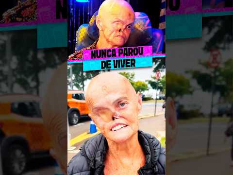 ELA NUNCA DEIXOU O CÂNCER VENCER