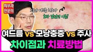 여드름치료가 효과 없었던 이유! 여드름VS모낭충증VS주사 정확하게 구별하는 방법과 치료ㅣ피부과에 헛돈 쓰신 분들 필수 시청!
