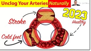 ❤️ 3 Clinically Proven Ways To Unclog &amp; Clean Your Arteries, Naturally - by Dr Sam Robbins
