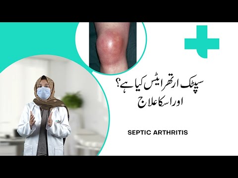 Septic Arthritis - Symptoms and Causes!