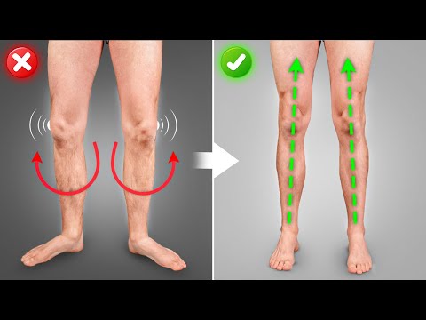 Fix Duck Feet FAST (in 30 Days)