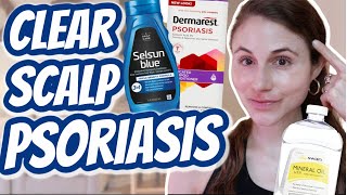 How to CLEAR SCALP PSORIASIS| Dr Dray
