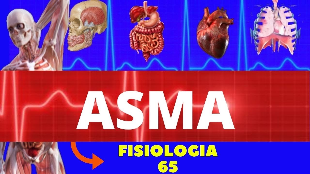 ASMA (DOENÇA OBSTRUTIVA RESPIRATÓRIA) - FISIOLOGIA DE RESPIRATÓRIA - FISIOLOGIA DE GUYTON