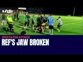Referee Has Jaw Broken By A Spectator At A Sydney Soccer Match