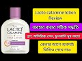 Lacto Calamine Face Lotion Review Lacto Calamine Face Lotion Review In Bengali