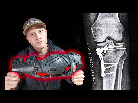 Why I Will NEVER Wear These On My Dirt Bike Again