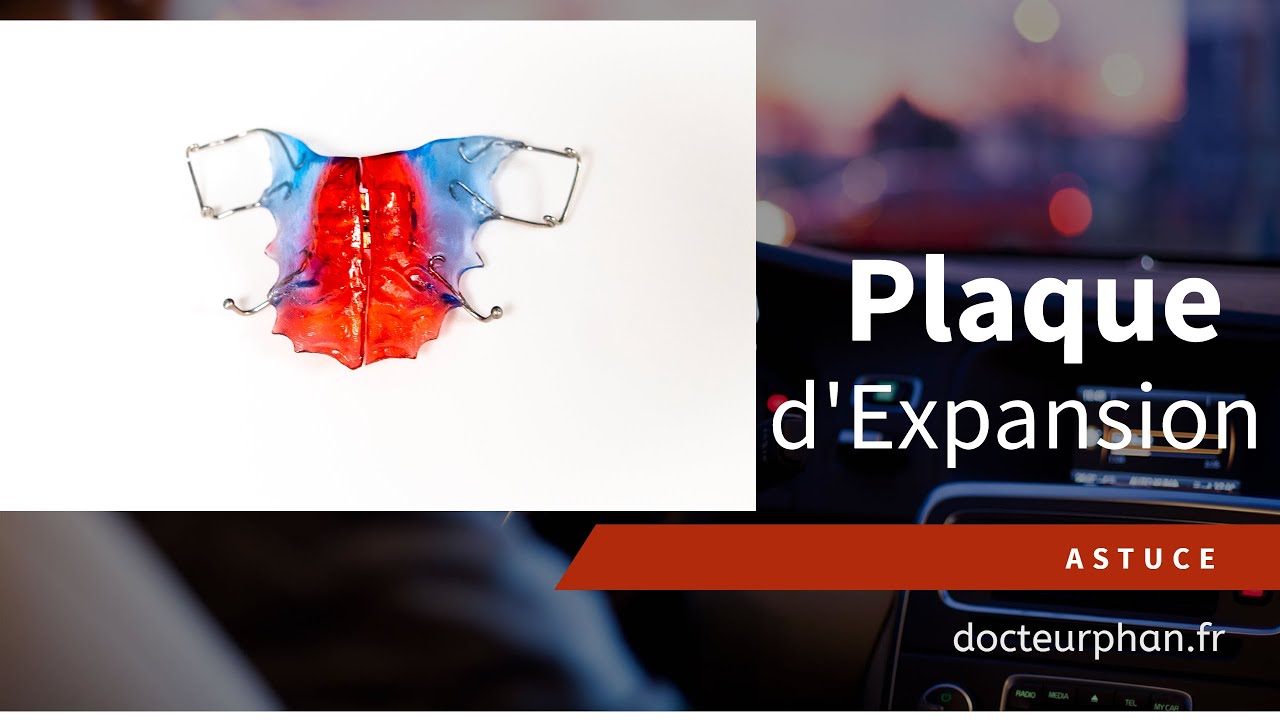 Activation d'une plaque d'expansion